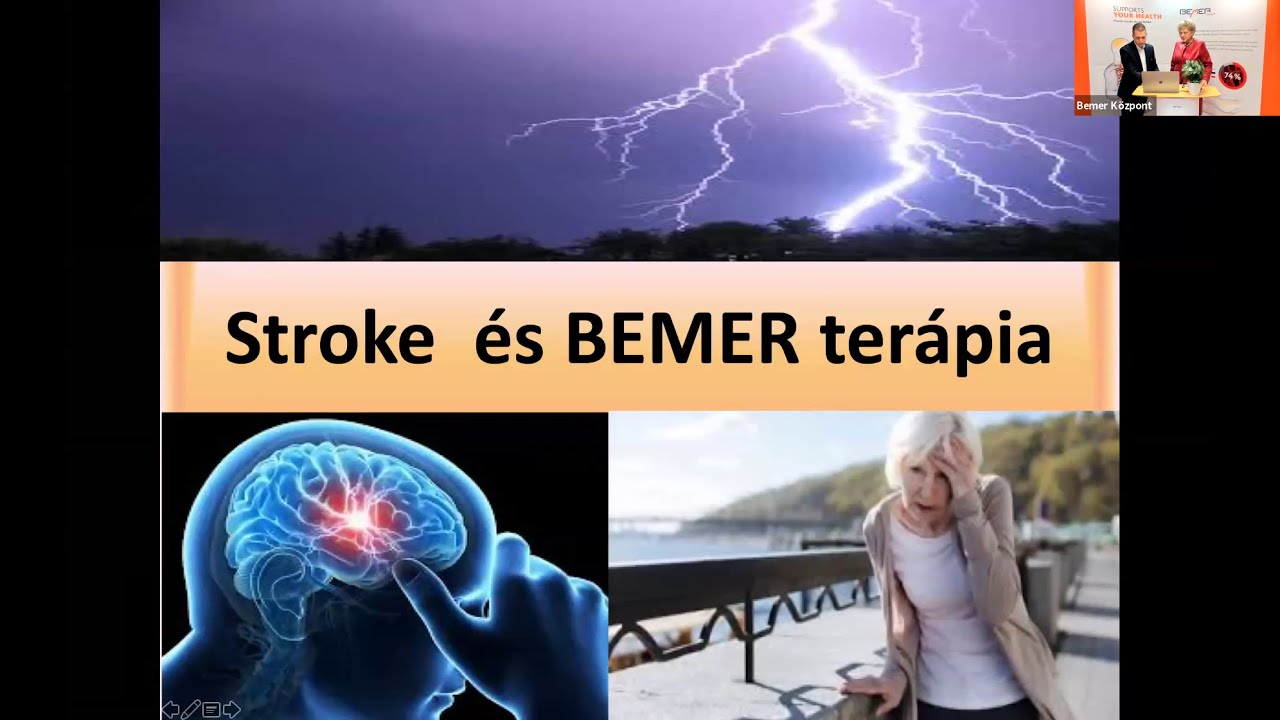 Stroke rehabilitációja - Bemer terápia